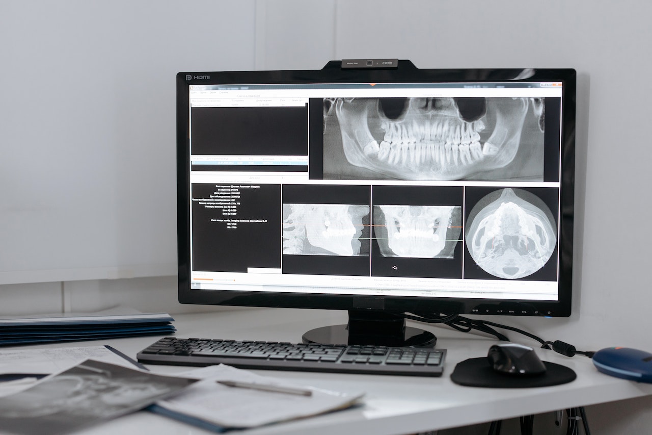 Importance of Dental X-Rays 2023